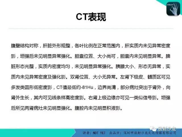 【病例】肾脏血管平滑肌脂肪瘤1例CT影像表现