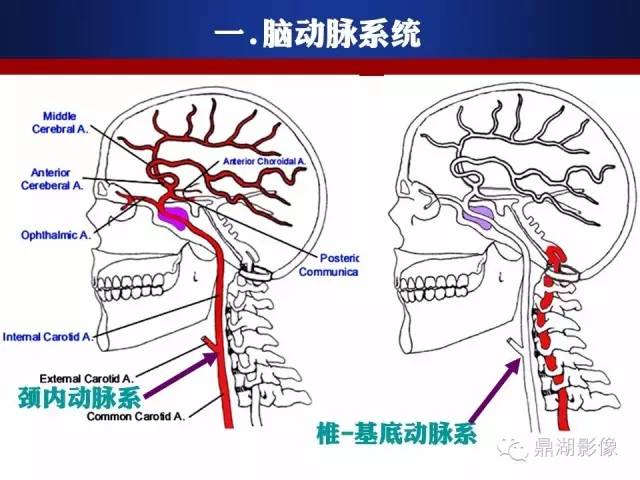 颅内动脉解剖详解