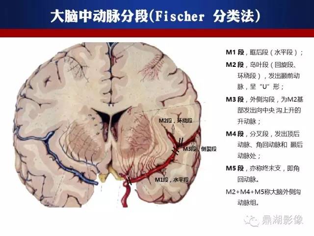 颅内动脉解剖详解