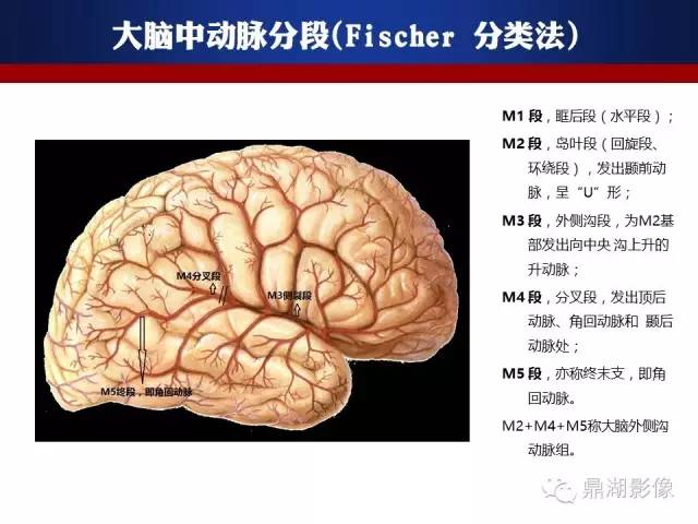 颅内动脉解剖详解