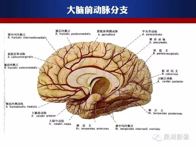 颅内动脉解剖详解
