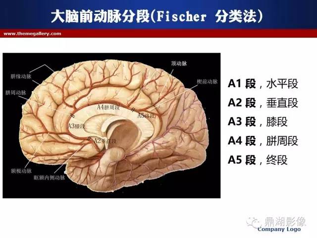颅内动脉解剖详解