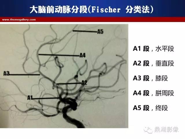 颅内动脉解剖详解