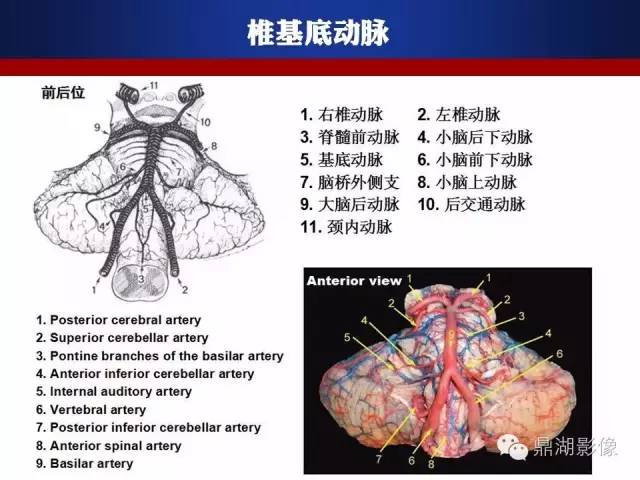 颅内动脉解剖详解
