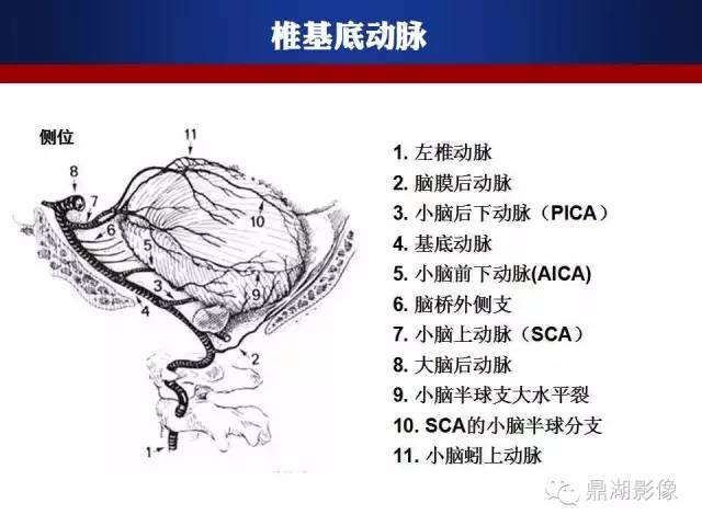 颅内动脉解剖详解