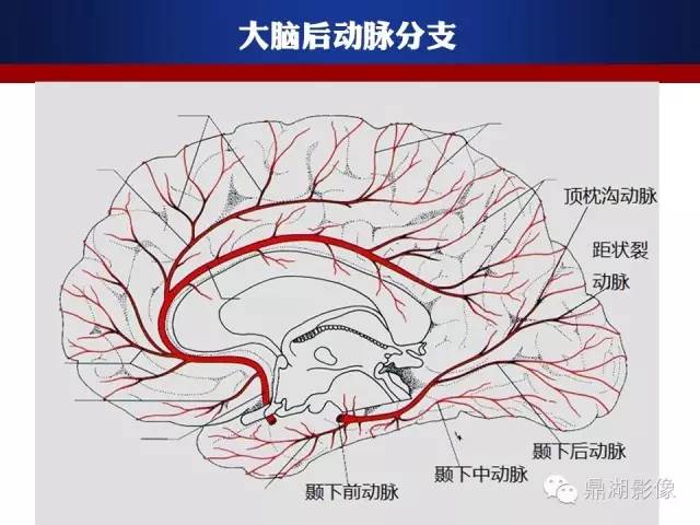 颅内动脉解剖详解