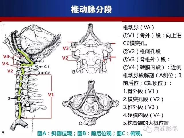 颅内动脉解剖详解