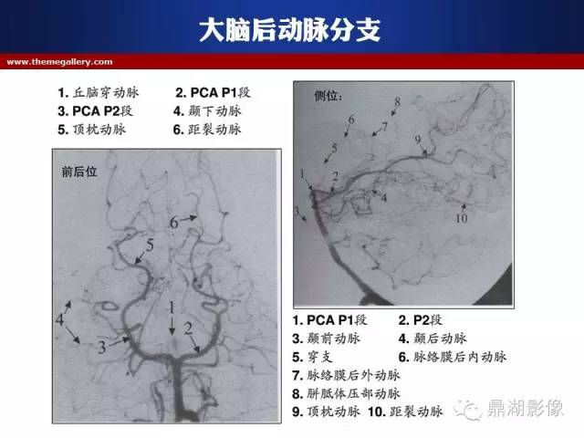 颅内动脉解剖详解