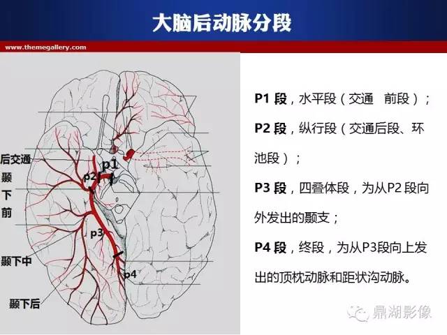 颅内动脉解剖详解