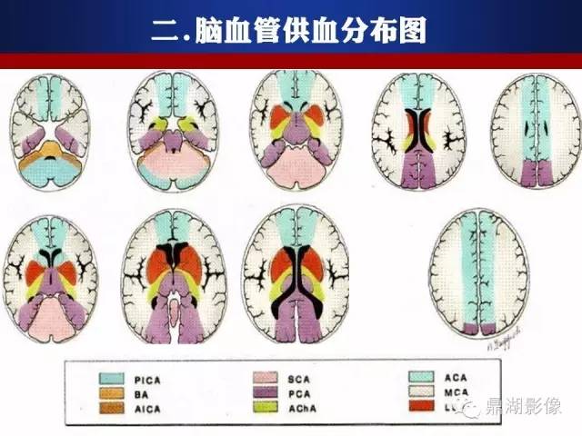 颅内动脉解剖详解
