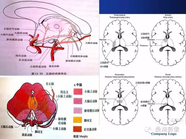 颅内动脉解剖详解