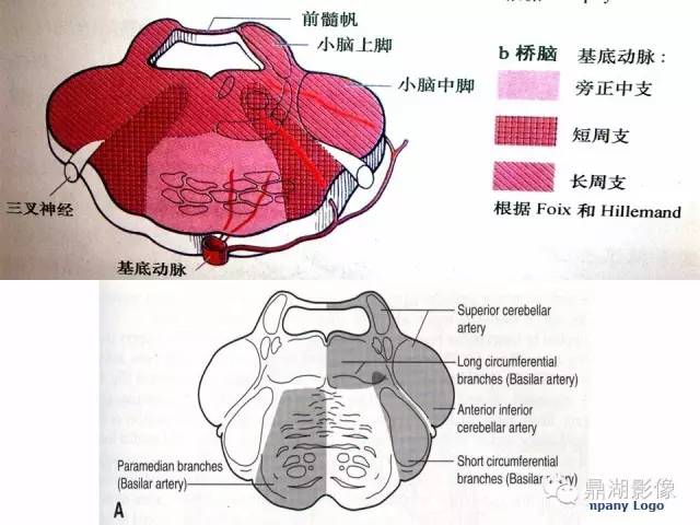 颅内动脉解剖详解