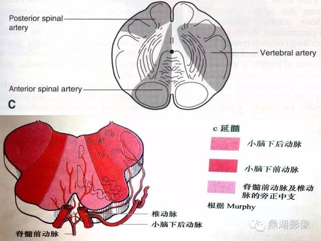 颅内动脉解剖详解