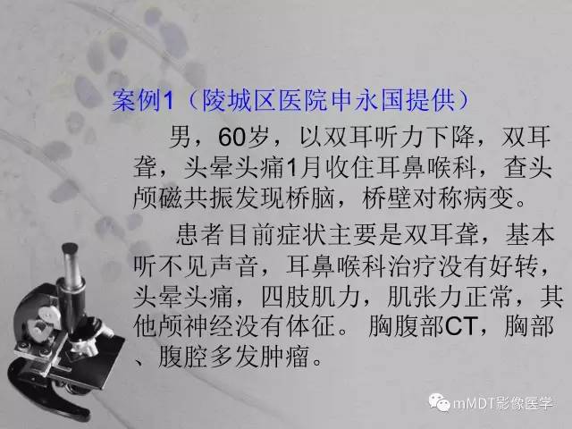 【PPT】脑干周围高信号，转移？免疫？ 一个远未解决的问题