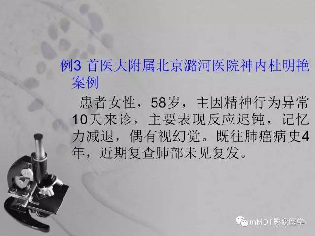 【PPT】脑干周围高信号，转移？免疫？ 一个远未解决的问题