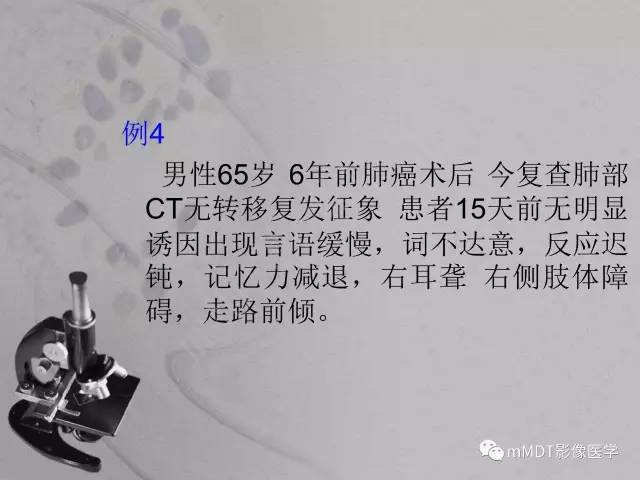 【PPT】脑干周围高信号，转移？免疫？ 一个远未解决的问题