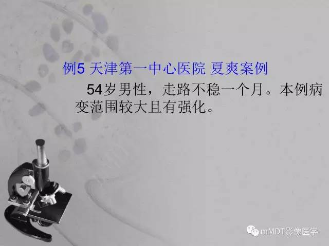 【PPT】脑干周围高信号，转移？免疫？ 一个远未解决的问题