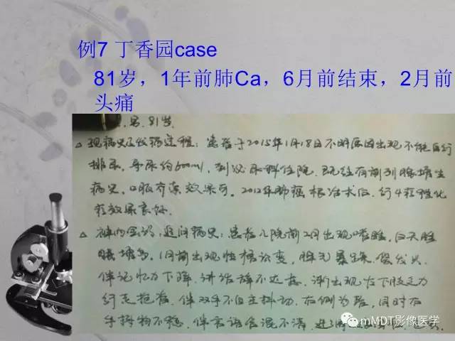 【PPT】脑干周围高信号，转移？免疫？ 一个远未解决的问题