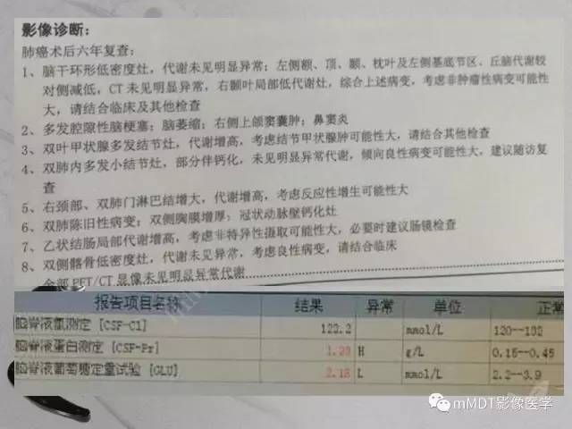 【PPT】脑干周围高信号，转移？免疫？ 一个远未解决的问题