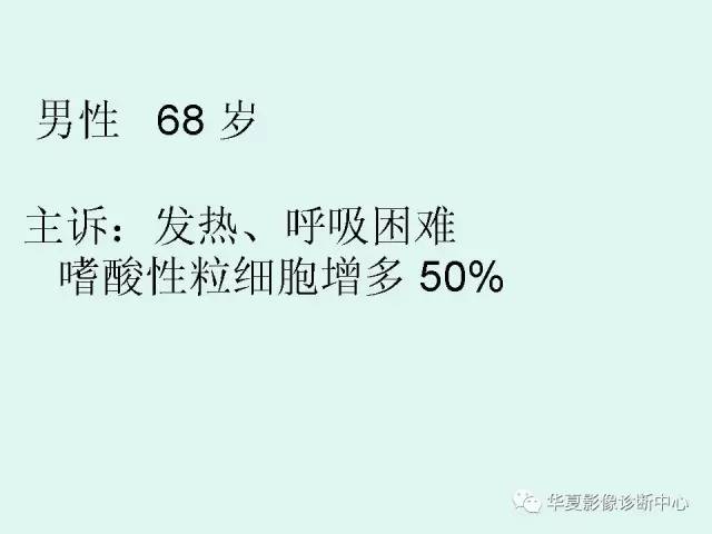 【病例】肺淋巴瘤一例CT