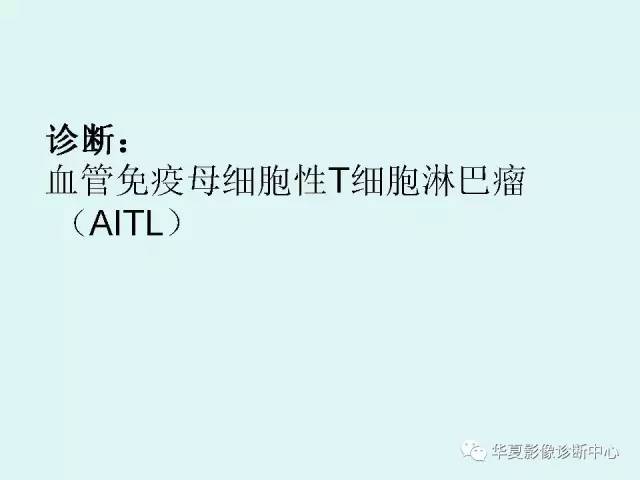 【病例】肺淋巴瘤一例CT