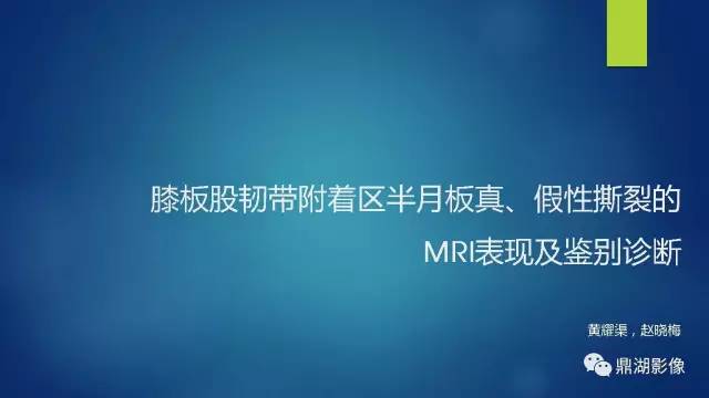 【PPT】膝关节板股韧带附着区半月板真、假性撕裂的MRI表现及鉴别诊断
