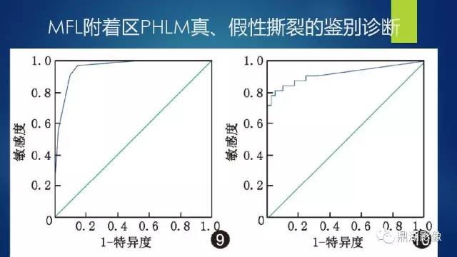 【PPT】膝关节板股韧带附着区半月板真、假性撕裂的MRI表现及鉴别诊断