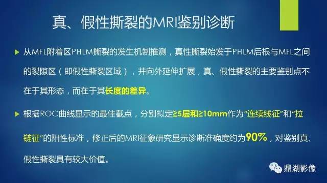 【PPT】膝关节板股韧带附着区半月板真、假性撕裂的MRI表现及鉴别诊断