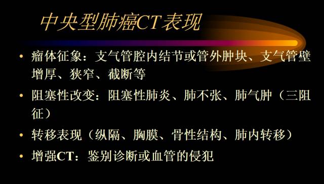 【PPT】肺肿瘤