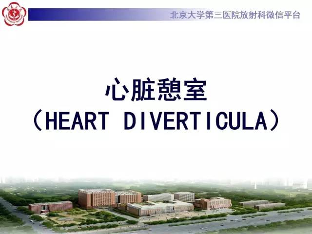 【病例】心脏憩室1例MR影像表现