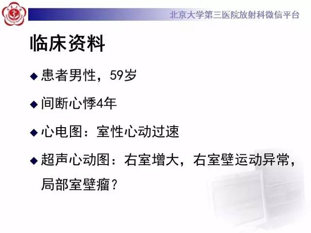 【病例】致心率失常性心肌病1例MR