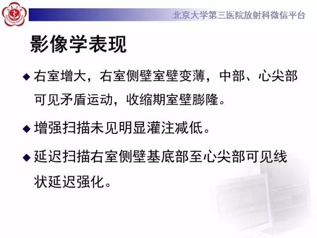 【病例】致心率失常性心肌病1例MR