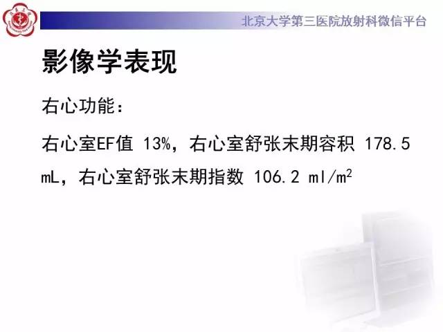 【病例】致心率失常性心肌病1例MR