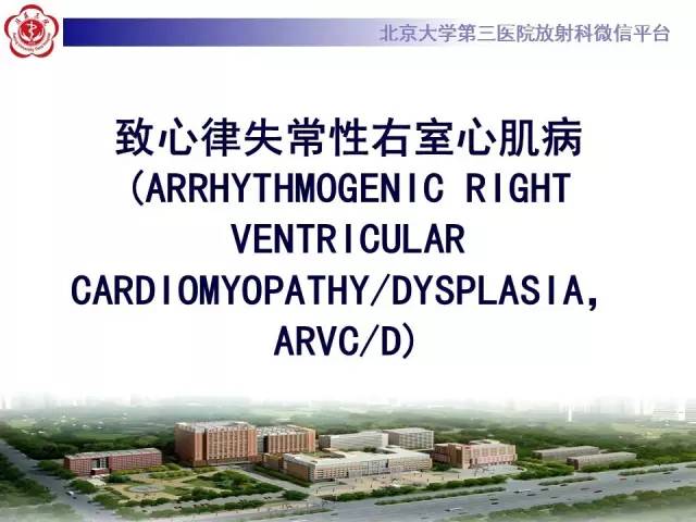 【病例】致心率失常性心肌病1例MR