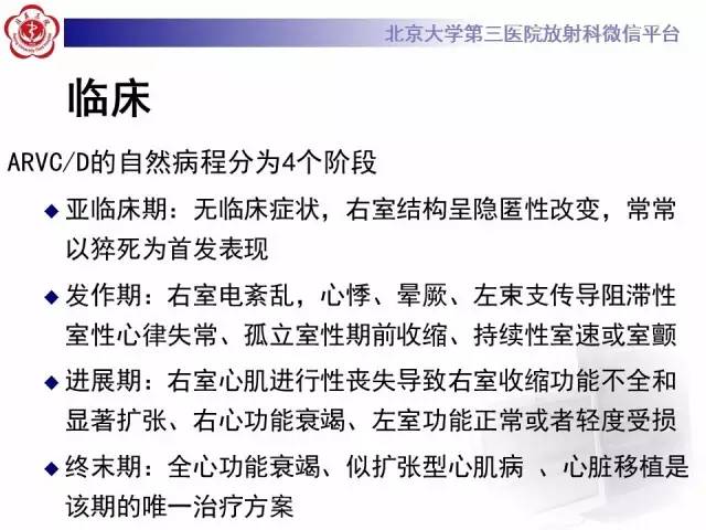 【病例】致心率失常性心肌病1例MR