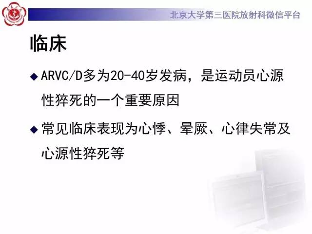 【病例】致心率失常性心肌病1例MR