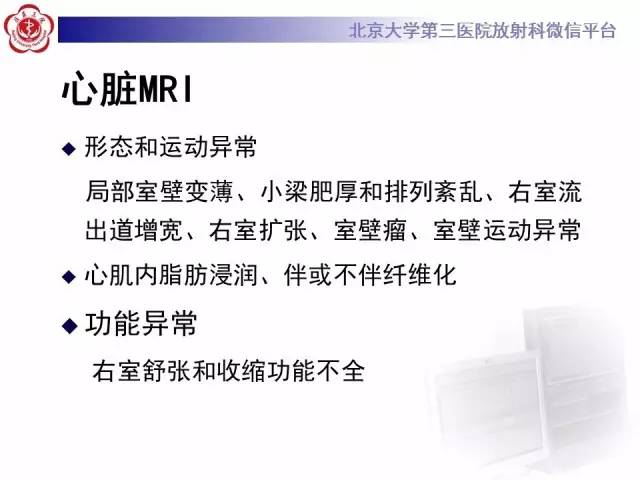 【病例】致心率失常性心肌病1例MR