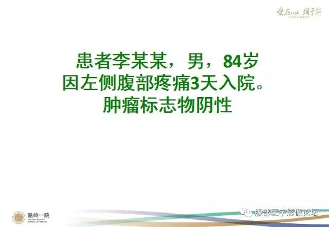 【病例】腹膜后嗜铬细胞瘤1例CT影像表现