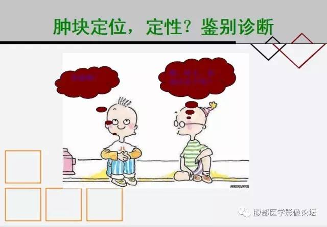 【病例】腹膜后嗜铬细胞瘤1例CT影像表现 【病例】腹膜后嗜铬细胞瘤1例CT影像表现