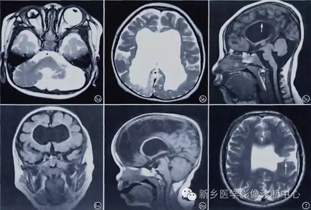 看到垂体柄异常，要想到的18种疾病