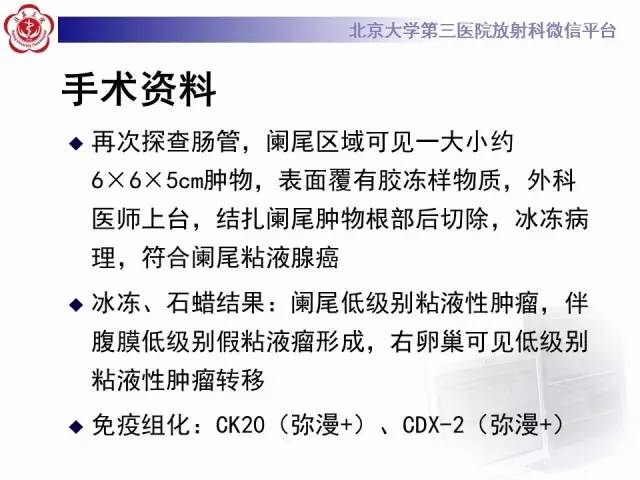 【病例】阑尾粘液性肿瘤1例CT及MR影像表现与鉴别