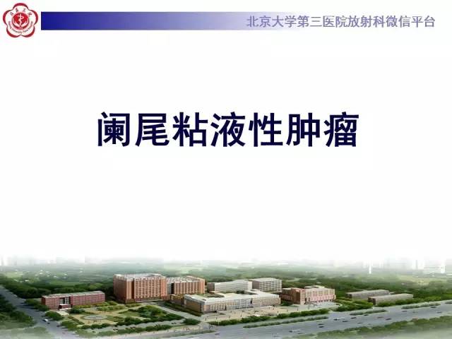 【病例】阑尾粘液性肿瘤1例CT及MR影像表现与鉴别