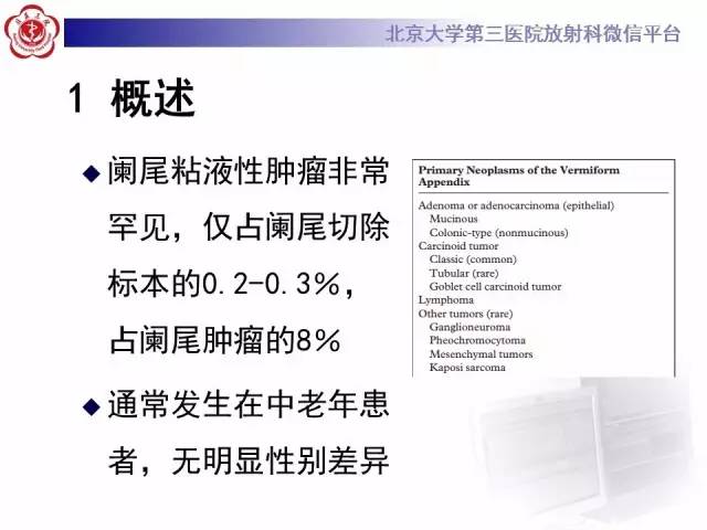 【病例】阑尾粘液性肿瘤1例CT及MR影像表现与鉴别