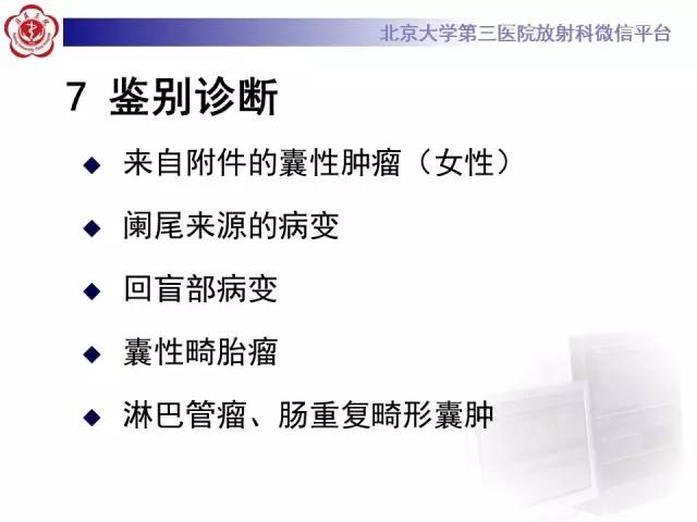 【病例】阑尾粘液性肿瘤1例CT及MR影像表现与鉴别