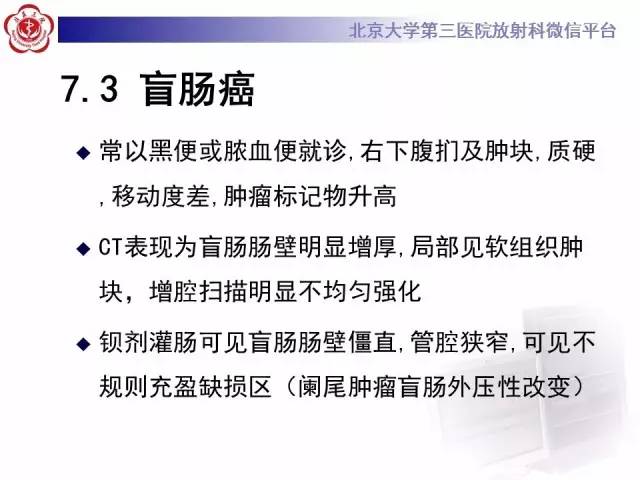 【病例】阑尾粘液性肿瘤1例CT及MR影像表现与鉴别