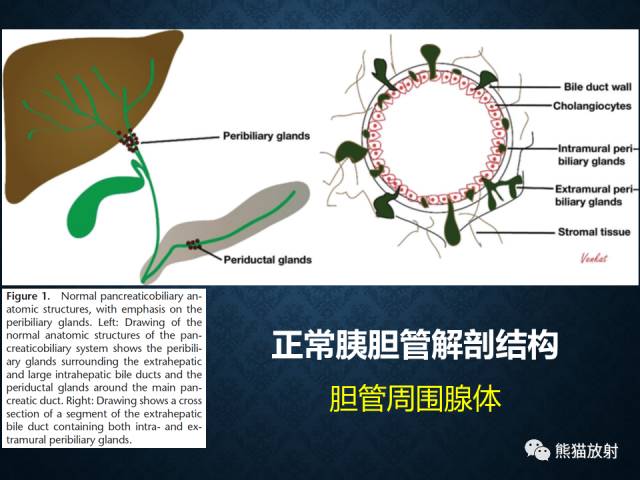 【专题】“对应性胆胰疾病”的影像表现 【专题】“对应性胆胰疾病”的影像表现
