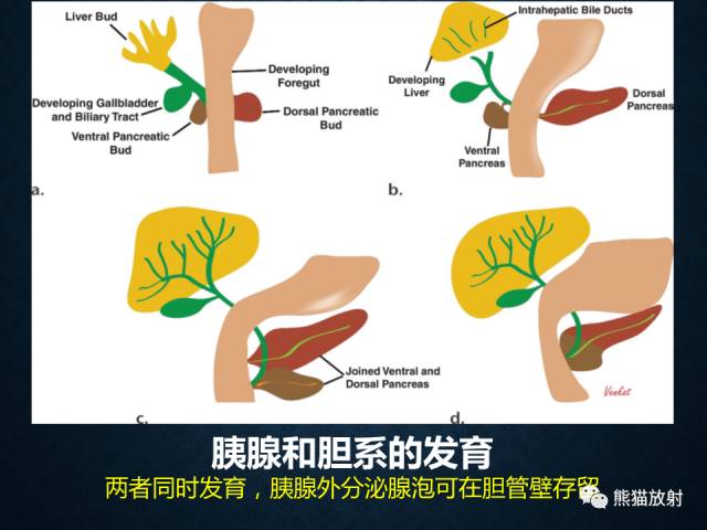 【专题】“对应性胆胰疾病”的影像表现 【专题】“对应性胆胰疾病”的影像表现