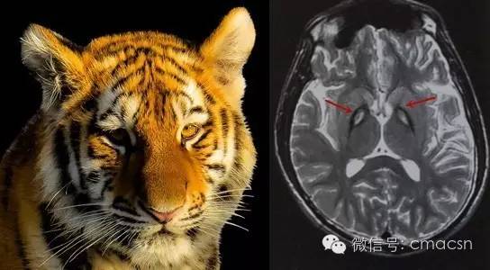 这9类影像征象分别提示哪些疾病? 这9类影像征象分别提示哪些疾病?