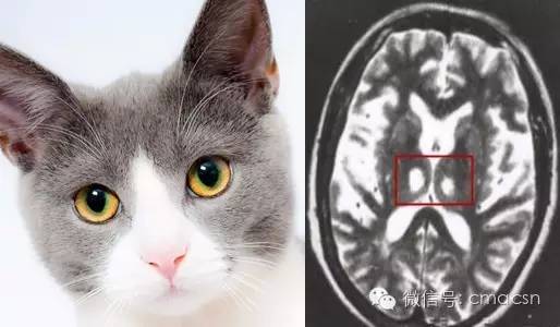 这9类影像征象分别提示哪些疾病? 这9类影像征象分别提示哪些疾病?