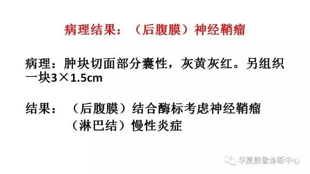 【病例】腹膜后神经鞘瘤1例CT影像表现